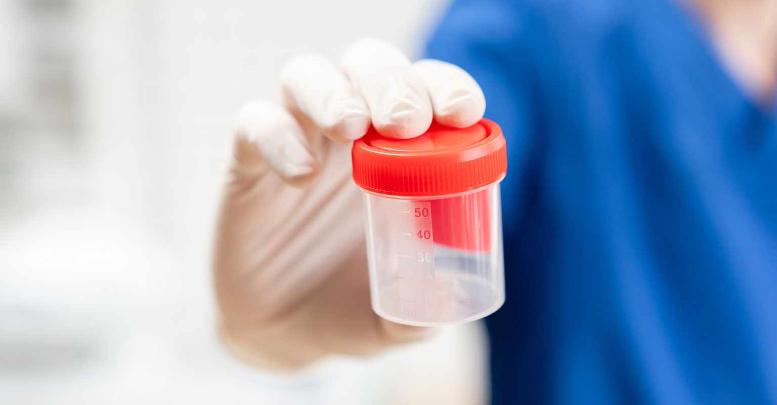 sterile container used for specimen collection